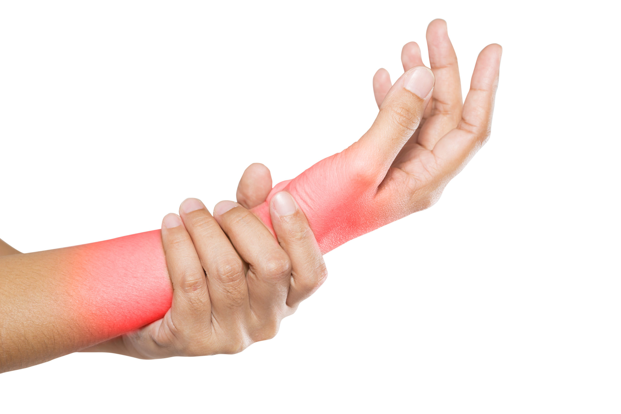 Carpal Tunnel Syndrome